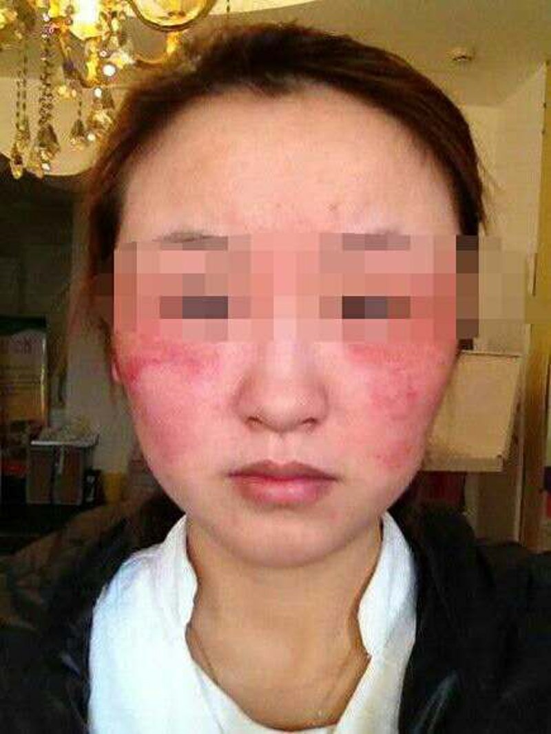 保定皮肤病医院：探索皮肤健康的秘密