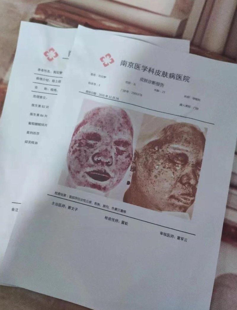 湿疹治疗新进展：寻找皮肤健康的秘密武器